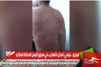 فيديو .. ليمني تعرض للتعذيب في سجون اليمن المدارة إماراتيا